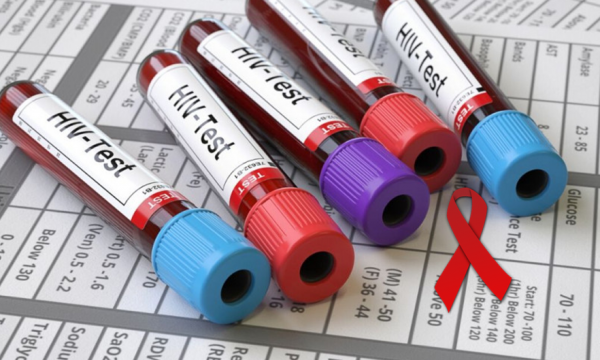 Trend shqetësues i rritjes së infektimeve me HIV në Kosovë, dhjetë ...